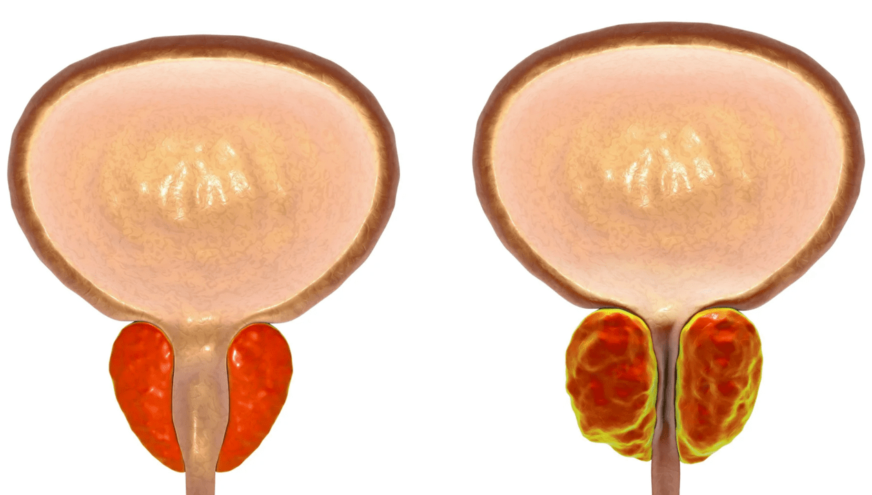 Што такое прастатыт